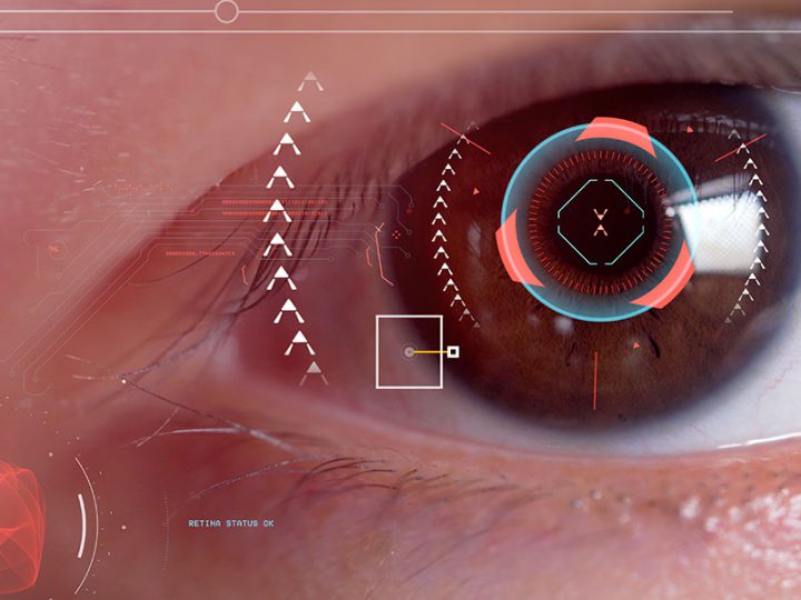 Article | Age-related Macular Degeneration