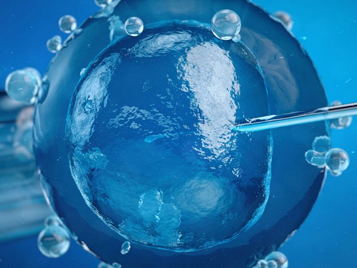 Article | KOLs: Stem Cell Transplantation (SCT) – UK